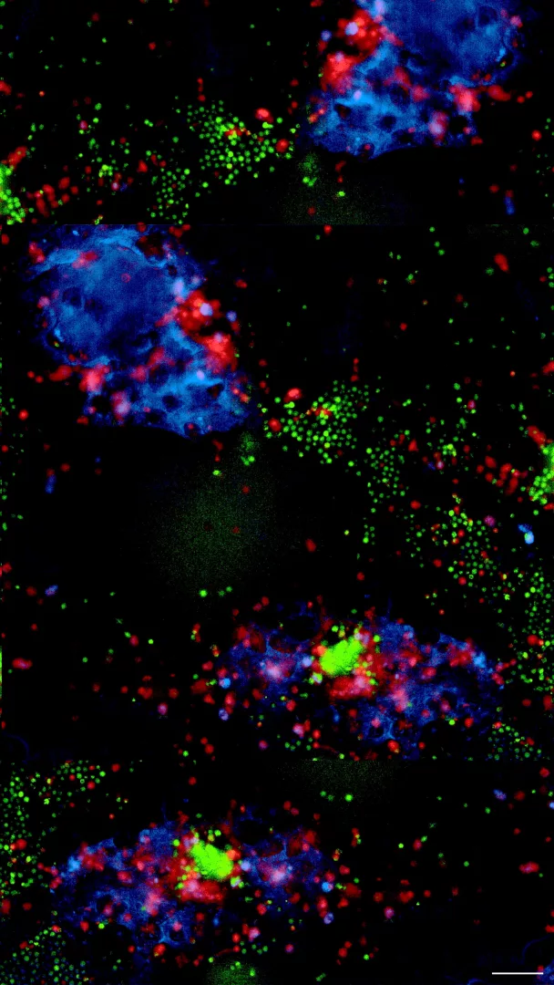 Oltre l'organoide: ricreare il microambiente tumorale gastrico ex vivo