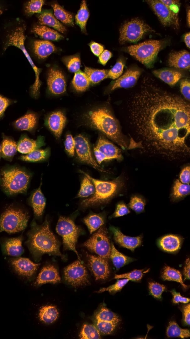 Colori contro il cancro