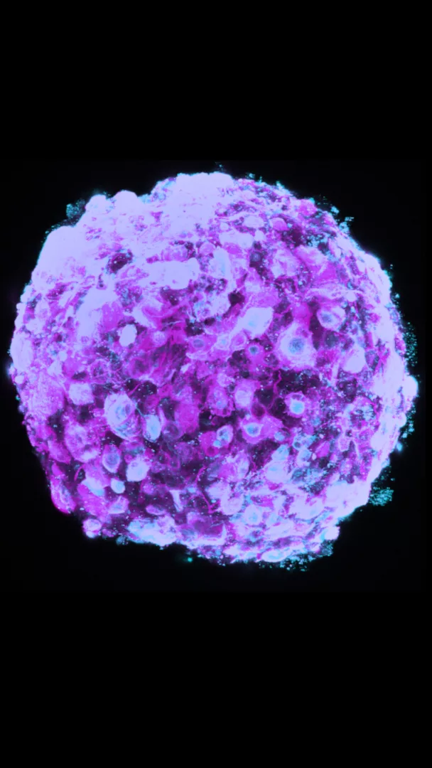 Neural Bloom