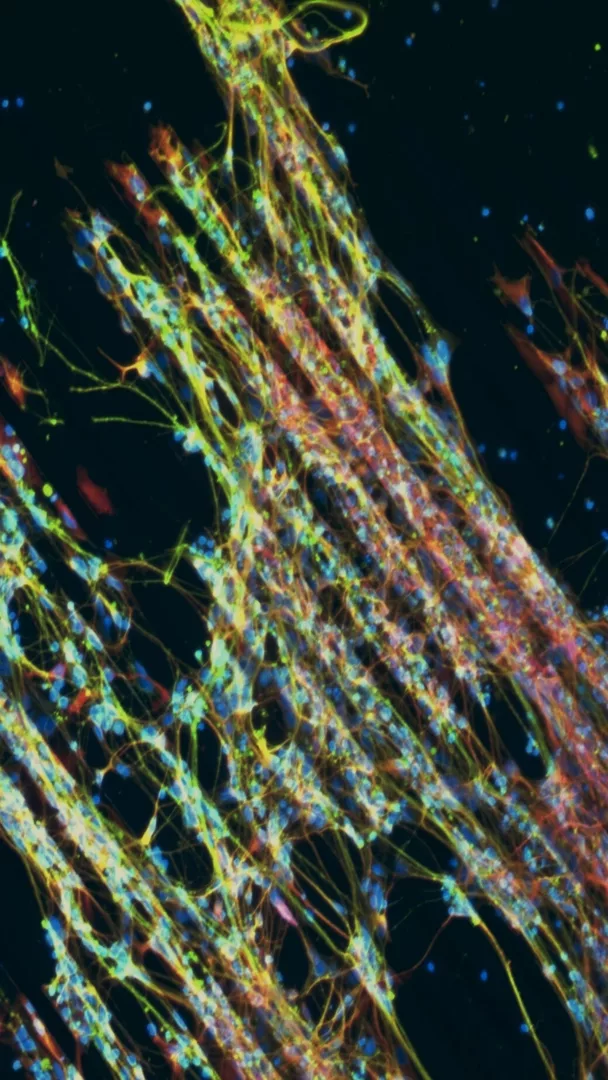 Neuroni in fila, connessioni che prendono forma