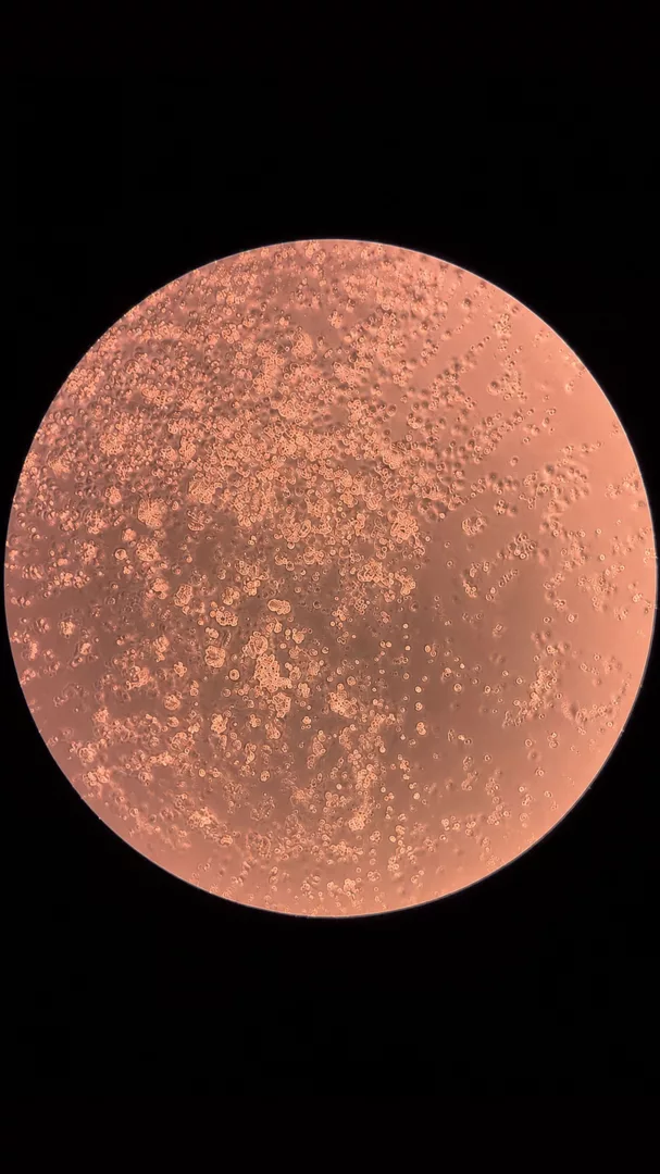 The Other Side of the Moon