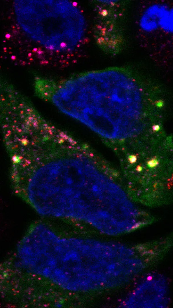 Hidden Worlds Inside a Cancer Cell.