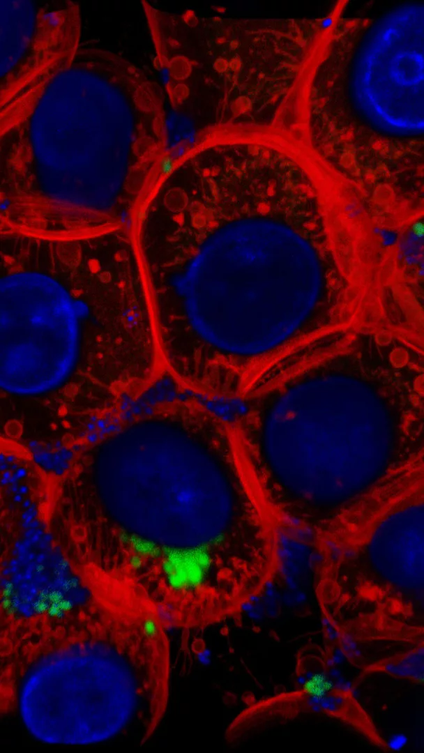 Dentro la cellula: l'invisibile battaglia contro Staphylococcus aureus