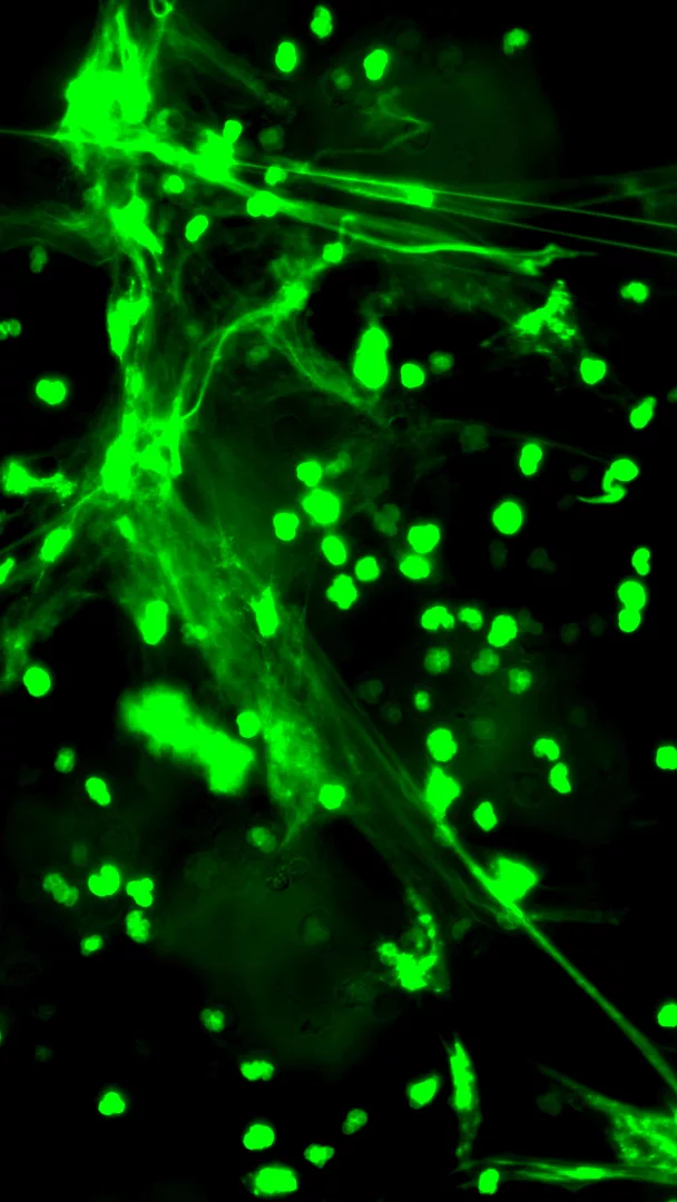 Ragnatele al microscopio: la tela del sistema immunitario