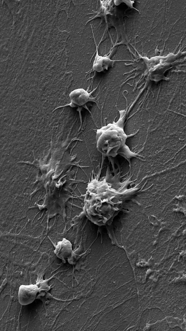 Le piastrine aderiscono ai vasi arteriosi infiammati