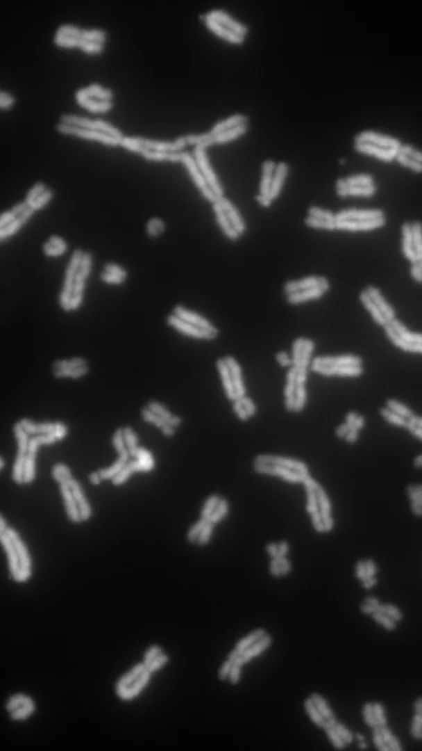 Frozen in Metaphase: A Chromosomal Elegy