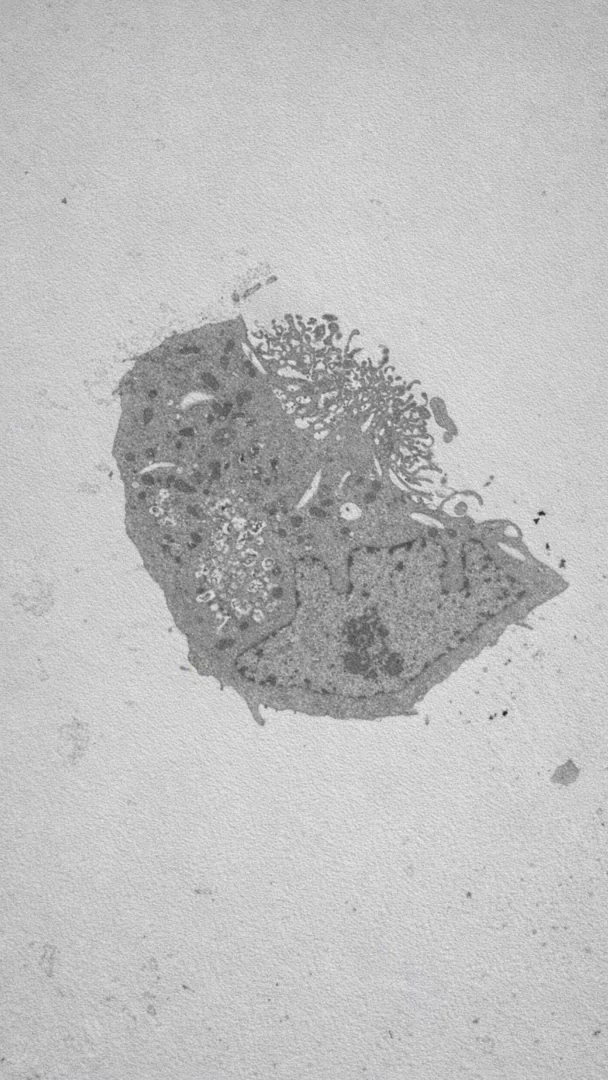 Il primo isolamento di SARS-CoV-2: evidenza ultrastrutturale dell'effetto citolitico