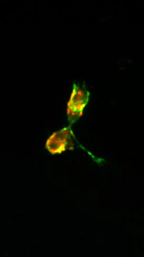 Una nuova fermata della ricerca: tra verde e rosso emerge una scoperta che collega sangue e cervello.