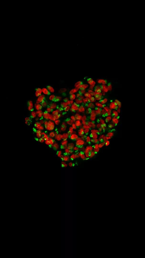 The HeArt of Glioblastoma